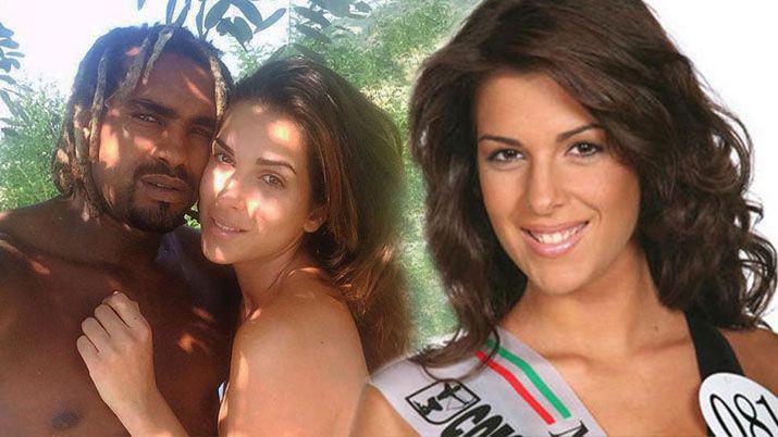 Italia- reconocida modelo fue atacada con aacutecido por su expareja