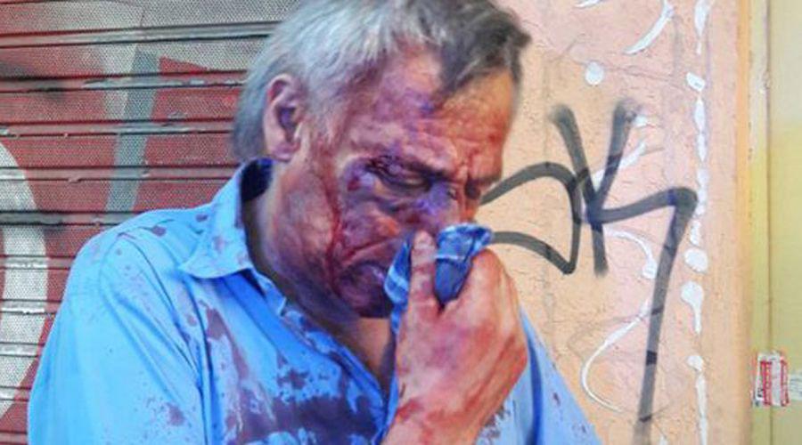 Brutal golpiza al chofer de un colectivo por no dejarlos viajar sin la SUBE