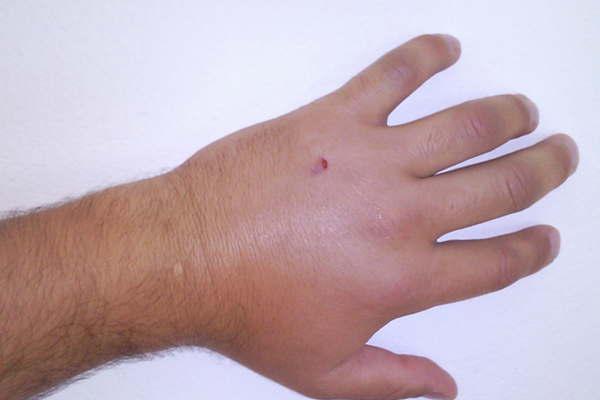 Las consecuencias se presentan con mayor gravedad en los nintildeos