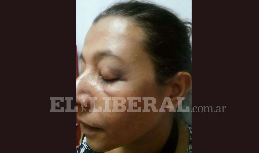 La mujer realizó la correspondiente denuncia pero no encontró soluciones