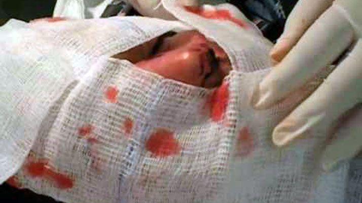 Brutal- tras discutir con su tiacuteo le fracturoacute el tabique de una trompada