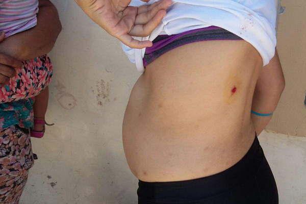 Mujer embarazada y otras dos personas heridas en un tiroteo