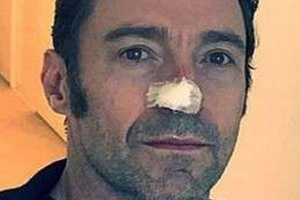 Hugh Jackman fue operado otra vez por su caacutencer de piel y se encuentra muy bien