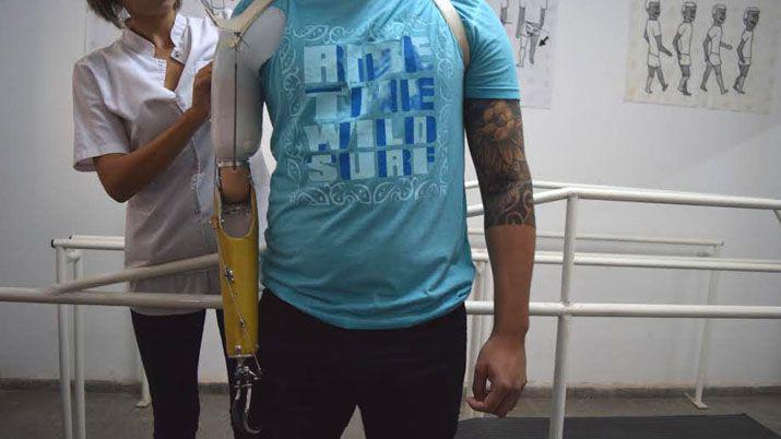 Realizaron el primer ensamble de un brazo mecnico en Santiago