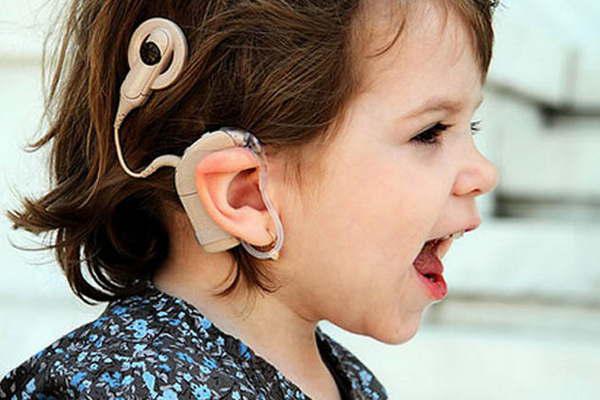 En el paiacutes se realizaron maacutes de 180 cirugiacuteas de implante coclear