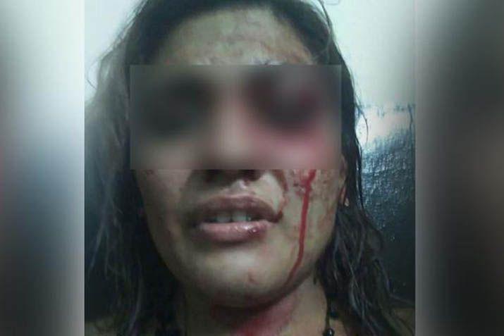 Denunció a su hermano por agresiones