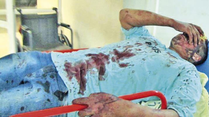 Una mujer se defendioacute del ataque de su marido y le reventoacute la cabeza con un palo