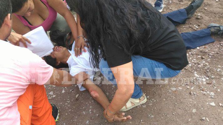 Ruta 34- menor con heridas graves al derrapar con su moto