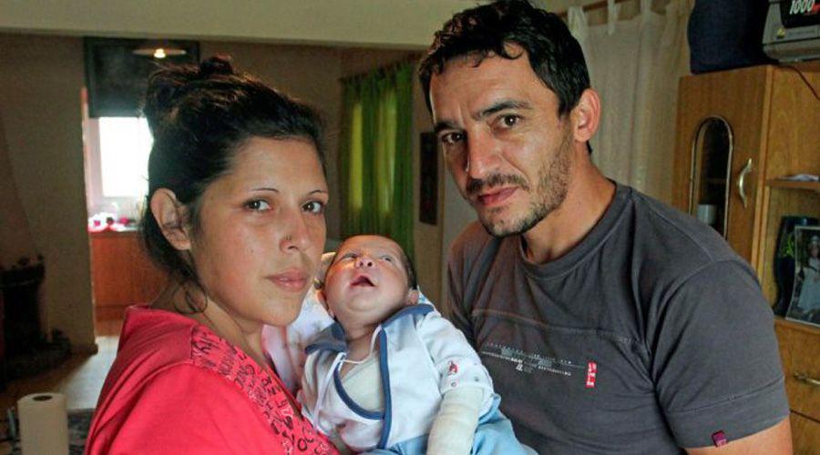 El bebeacute con piel de cristal que conmueve a Mendoza