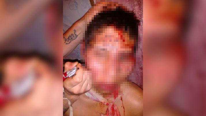 Un preso fue torturado durante siete horas y le tatuaron la cara