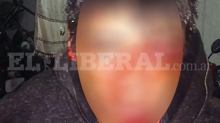 Vecinos desfiguraron a trompadas a un ladroacuten