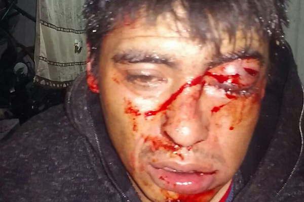 Ingresoacute a una casa a robar y fue linchado por el duentildeo y los vecinos 