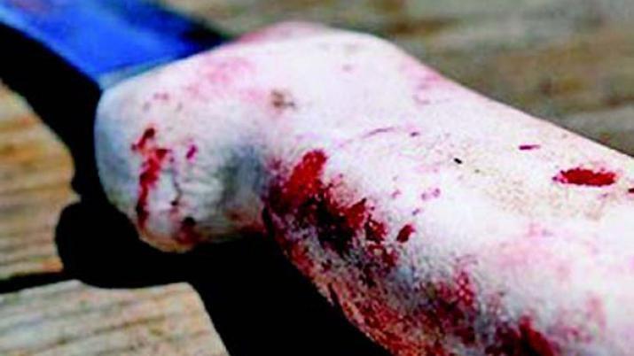 Joven fue apuntildealado y tuvo que ser derivado al hospital Regional