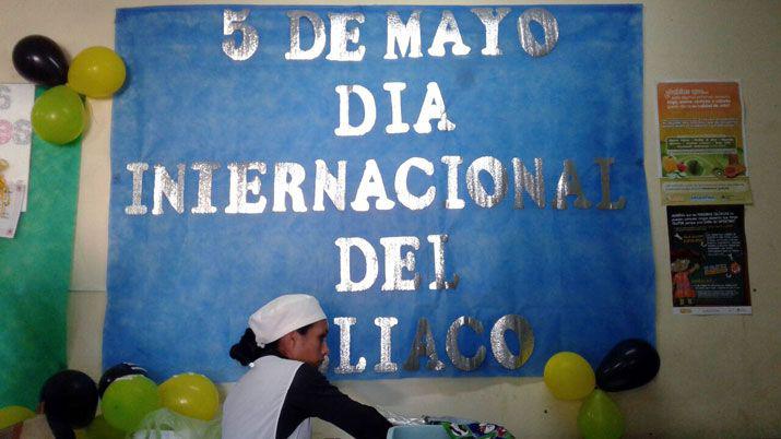 Aceband comienza sus festejos por sus 20 antildeos de trayectoria
