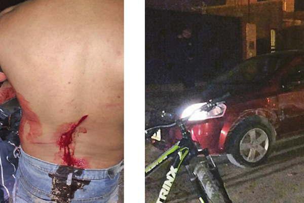 Chocoacute con un colectivo y lo acuchilloacute dos veces al chofer