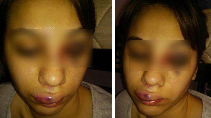 Denuncian en Facebook una brutal golpiza y abuso sexual