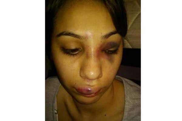 Ataque a una joven que se viralizoacute por Facebook movilizoacute a la policiacutea santiaguentildea 