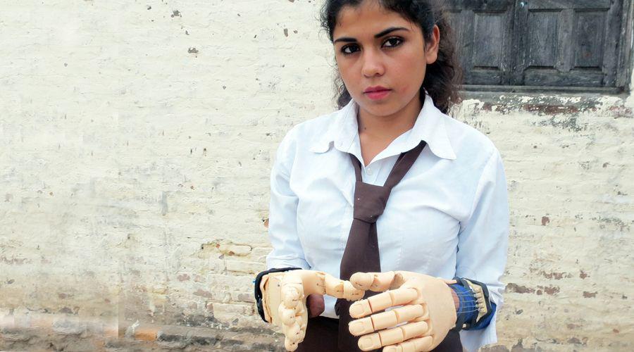 La historia de Camila la joven termense que logroacute recuperar sus manos