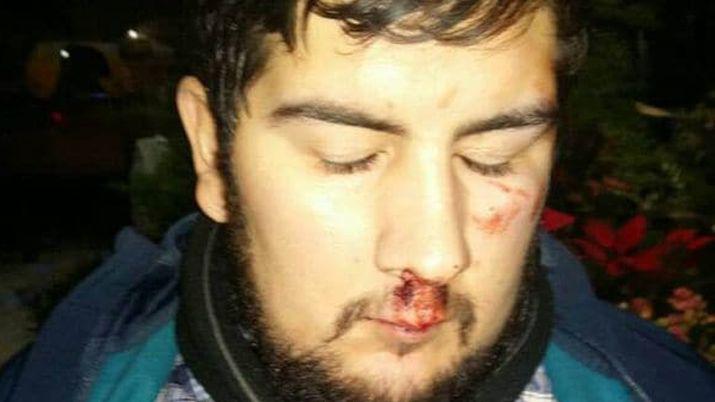 Insoacutelita respuesta- Le estaba sacando fotos a la cola de una maestra