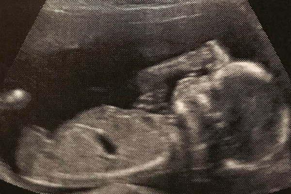 Flor Pentildea mostroacute la ecografiacutea de su bebeacute