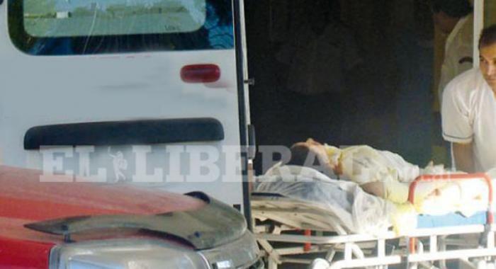 Adolescente sufrioacute quemaduras al caerle una pava con agua hervida