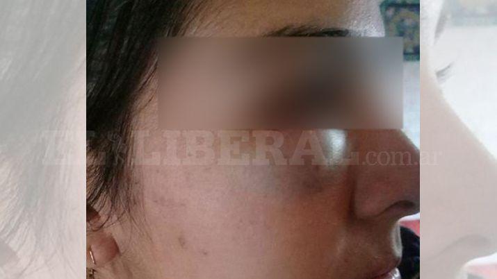 Se resistió al robo de su moto y la golpearon