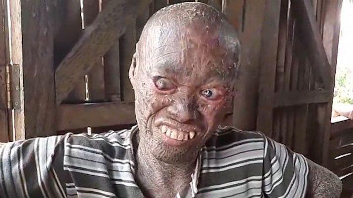 La impactante historia de vida del hombre serpiente