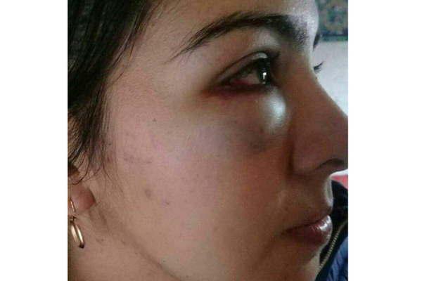 Sospechoso de desfigurar a una joven en un asalto fue detenido