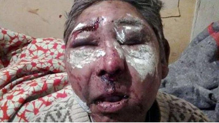 Salvaje agresión a un hombre al que le robaron un termo y 60