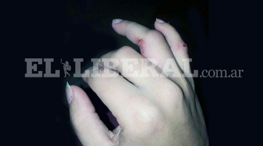 El charanguista Ramoacuten Aacutelvarez detuvo a golpes a un ladroacuten