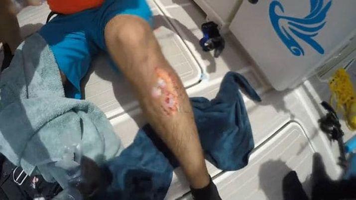 VIDEO Un pescador graboacute el momento exacto en que lo mordioacute un tiburoacuten