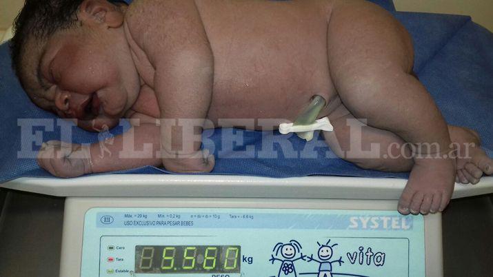 La Banda- nacioacute un suacuteper bebeacute de 5560 kg por parto natural