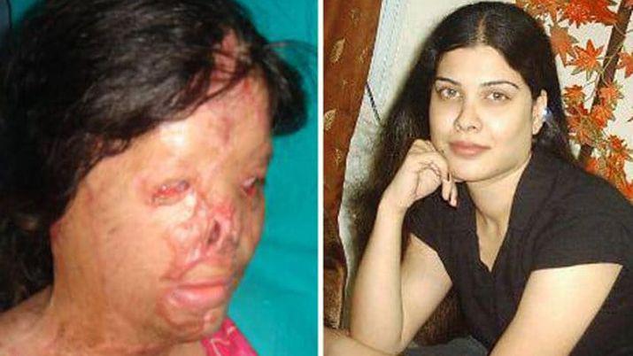 Escalofriante- Su mejor amiga le tiroacute aacutecido en la cara y arruinoacute su vida