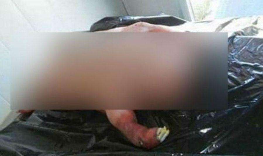 El nacimiento de un hombre-cordero conmociona a Sudaacutefrica