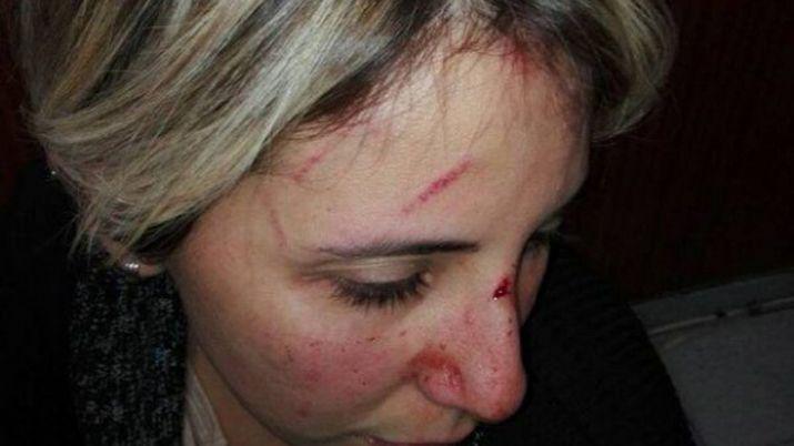 Denuncioacute a su jefe por golpearla cuando le preguntoacute cuando cobraba