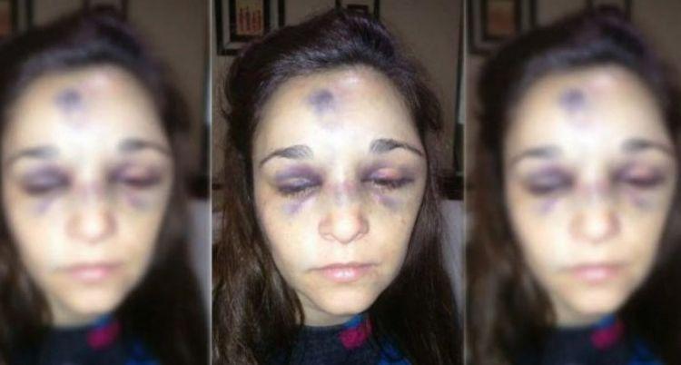 Un joven de 17 antildeos molioacute a golpes a su novia de 31