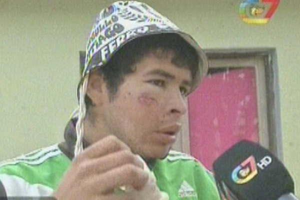 Un grave incidente entre bandas terminoacute con un adolescente baleado en la cara y una mujer presa