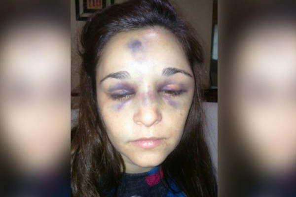 Murioacute una mujer golpeada por su pareja un joven de 17 antildeos