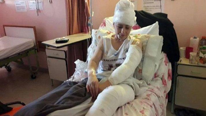 Jaurías de perros atacan a vecinos en Ushuaia