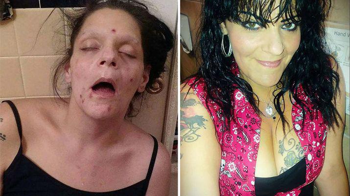 Duras imgenes del antes y el después