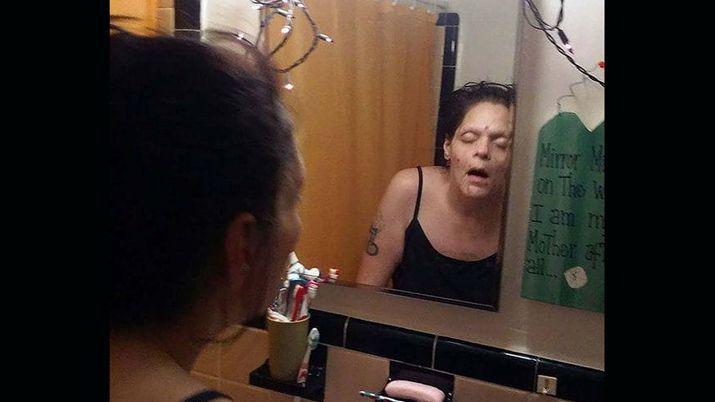 Impactantes imaacutegenes de la recuperacioacuten de una mujer adicta a la heroiacutena