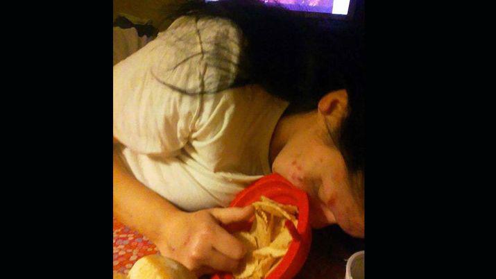 Impactantes imaacutegenes de la recuperacioacuten de una mujer adicta a la heroiacutena