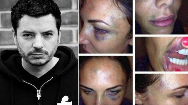 Cancelaron el show de un DJ condenado por golpear a su ex