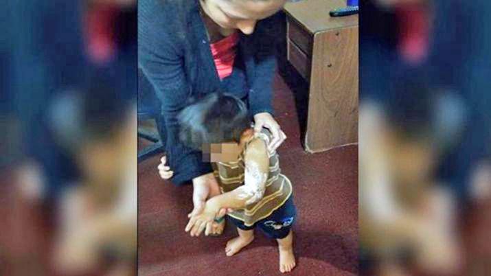 Le tiroacute agua hirviendo a su mujer y terminoacute quemando a su hijo