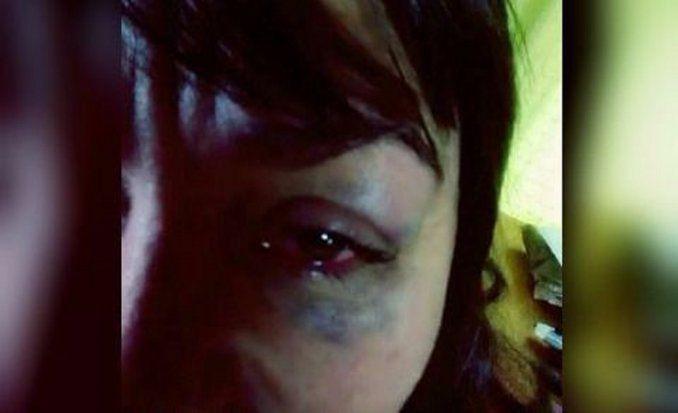 Le reventó el ojo de una trompada porque le dijo no