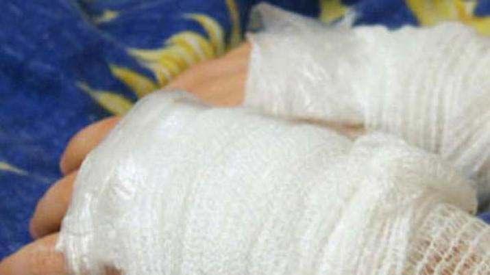 Bebeacute sufrioacute graves quemaduras tras caerle una fuente de agua hirviendo