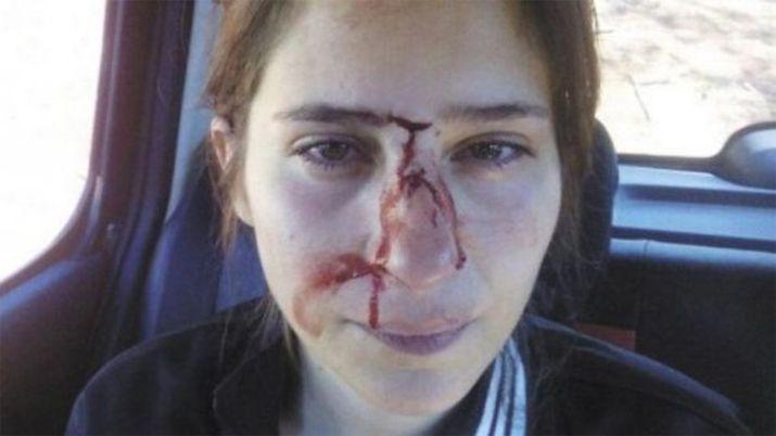 El calvario de una mujer golpeada- Te amo tanto que lo canalizo asiacute