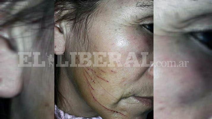 Golpearon y rasguntildearon en el rostro a una mujer para robarle