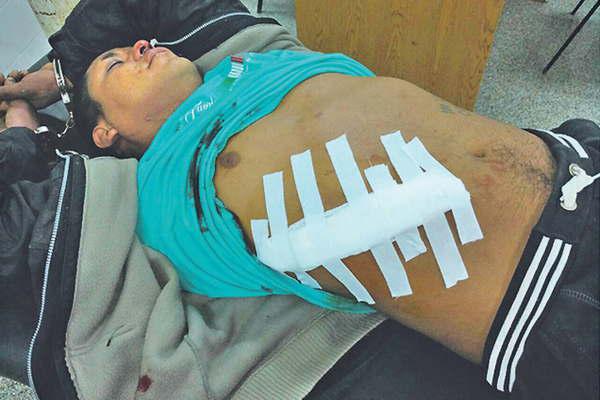 Un grupo de elite de la Policiacutea pulverizoacute los  40 diacuteas proacutefugo de Aacutengel Monito Castantildeo