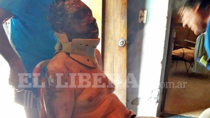 Sangriento ataque sufrioacute el profesor Joshela Scrimini en un violento asalto